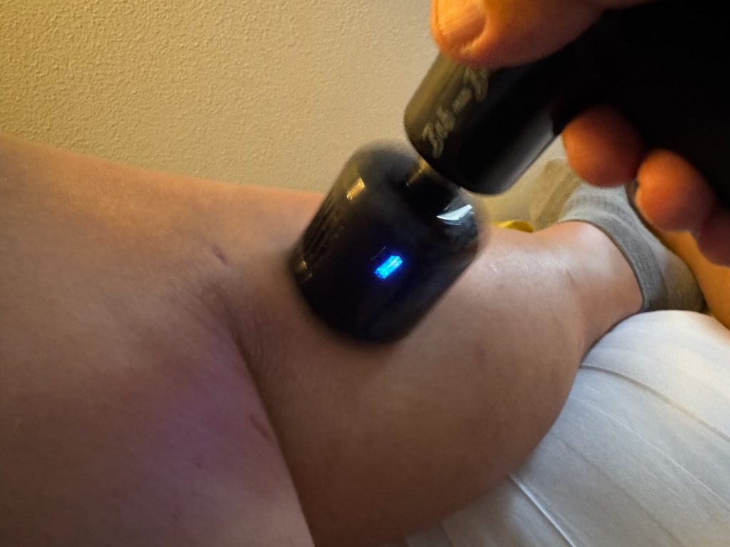 Massage nach Venen OP